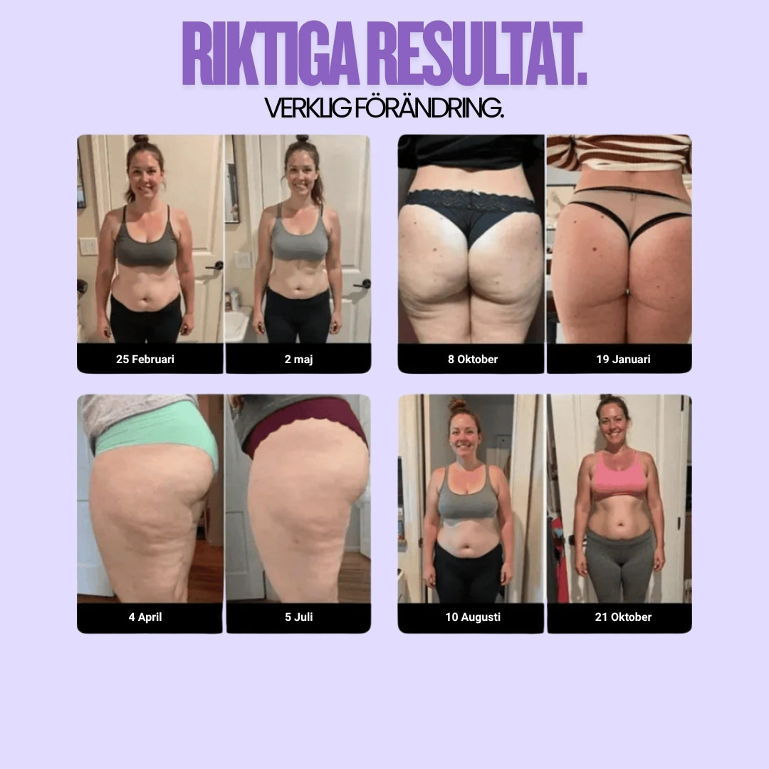 Cellulite SoreaPro 3D Leggings