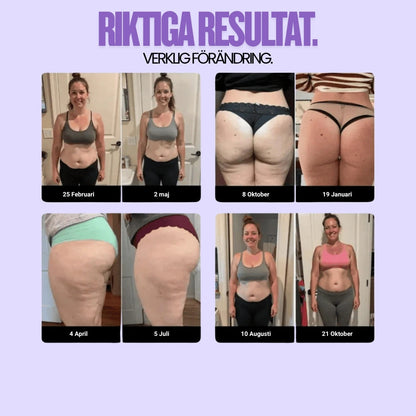 Cellulite SoreaPro 3D Leggings