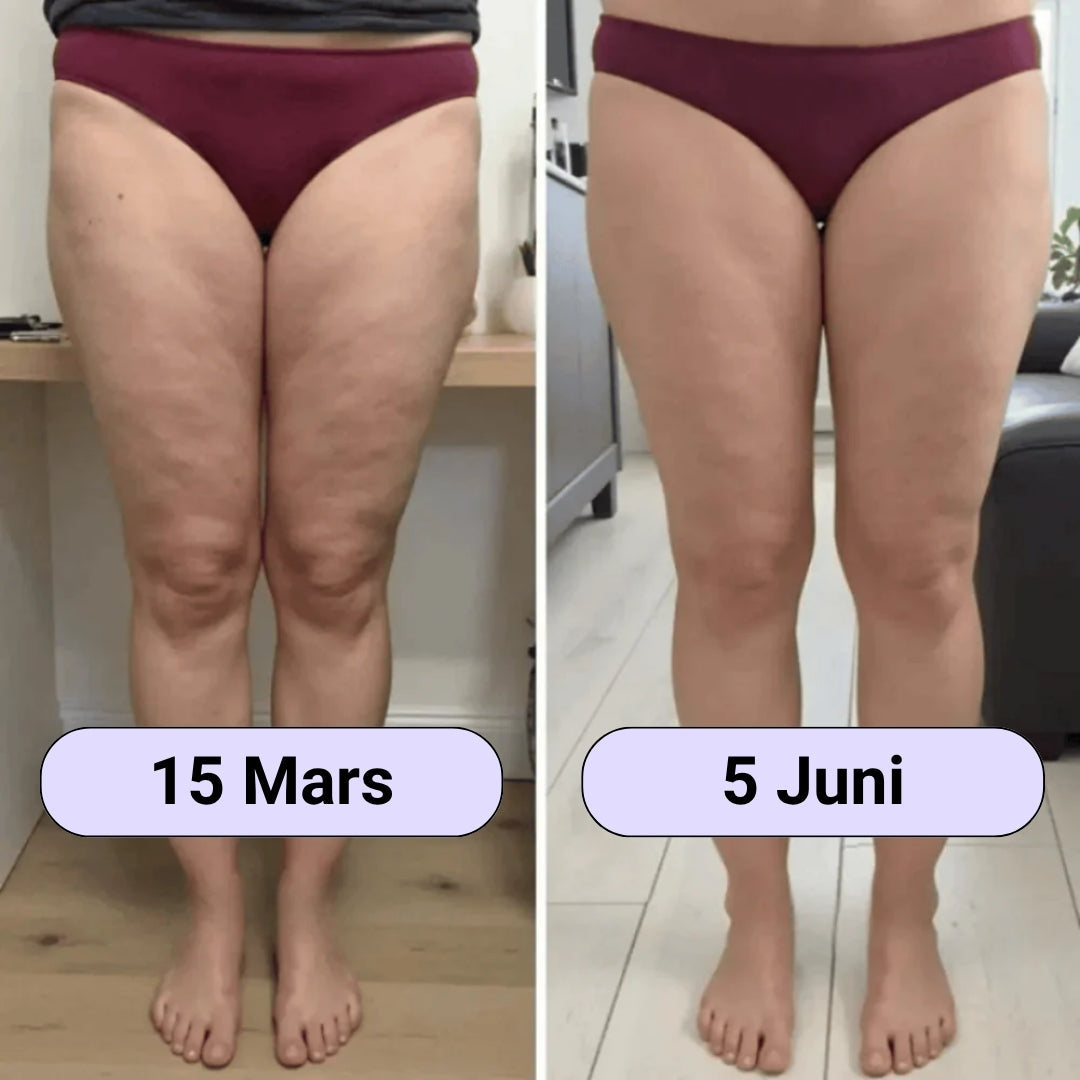 Cellulite SoreaPro 3D Leggings