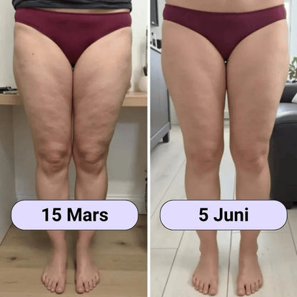 Cellulite SoreaPro 3D Leggings